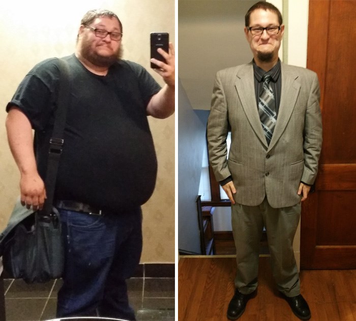 Confira 21 fotos incríveis do antes de depois de pessoas com excesso de peso